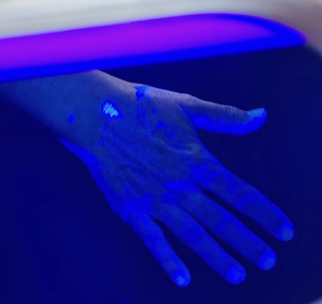 Hand2